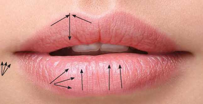 Стрілками вказані точки введення голки та напрямок лінійної нитки на губах